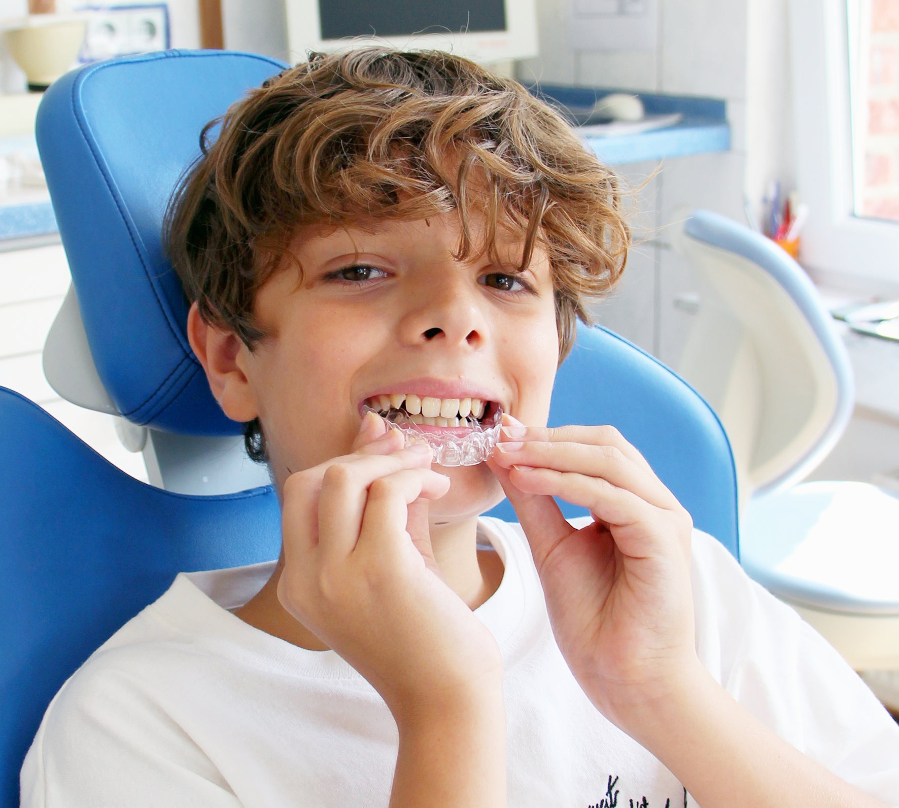 Aligner tretman